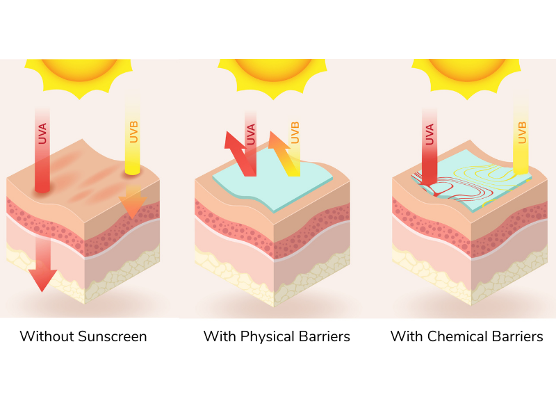 Image montrant la peau sans écran solaire, avec écran physique et chimique